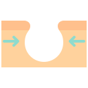 Epidermis 