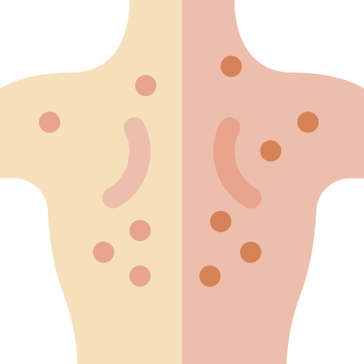 acne grátis ícone acne grátis ícone