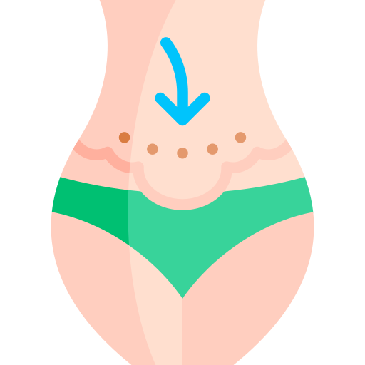 bauchstraffung kostenlos Icon