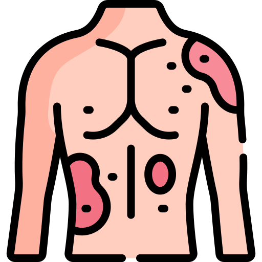 Icono De Urticaria Special Lineal Color 8089